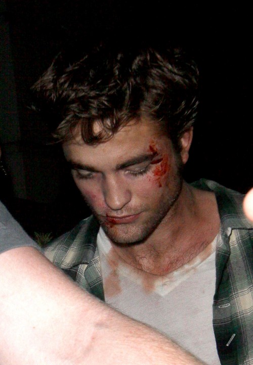robert-pattinson-beaten-on-set-of-remember-me